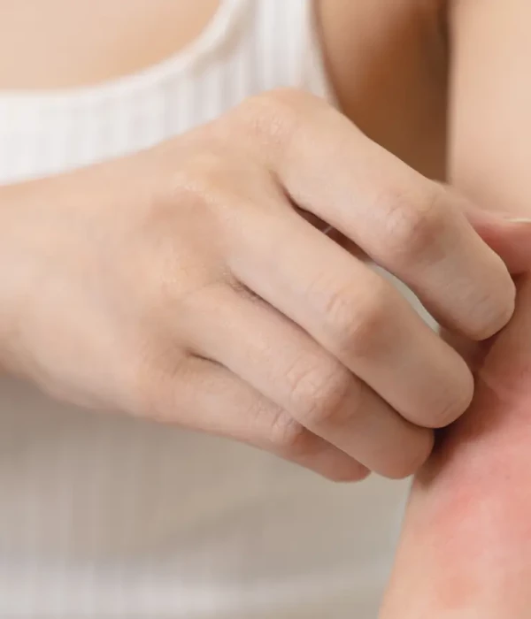 Picture of itchy, red skin. Click to learn more about our solution for acute and chronic itch.